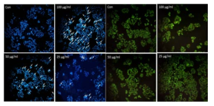 Anti-cancer activity of GEME - formation of apoptotic bodies in MCF-7 cells