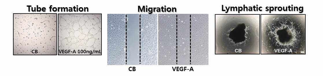 Tube formation, Migration, Thoracic duct ring assay