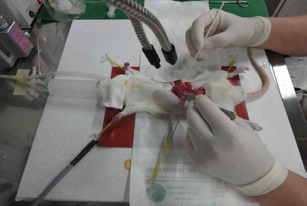 림프시료 채취관 및 십이지장 주입관 삽입 수술