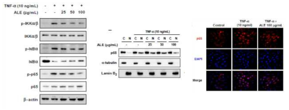 The inhibitory effect of ALE on TNF-α-induced NF-κB pathways and p65 translocation from cytosol to nucleus in HUVECs