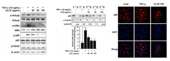 The inhibitory effect of LCE on TNF-α-induced NF-κB pathways and p65 translocation from cytosol to nucleus in HUVECs