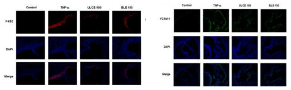 The inhibitory effect of LCE on TNF-α-induced macrophage infiltration to the vasulcar intima and VCAM-1 expression in mice aorta