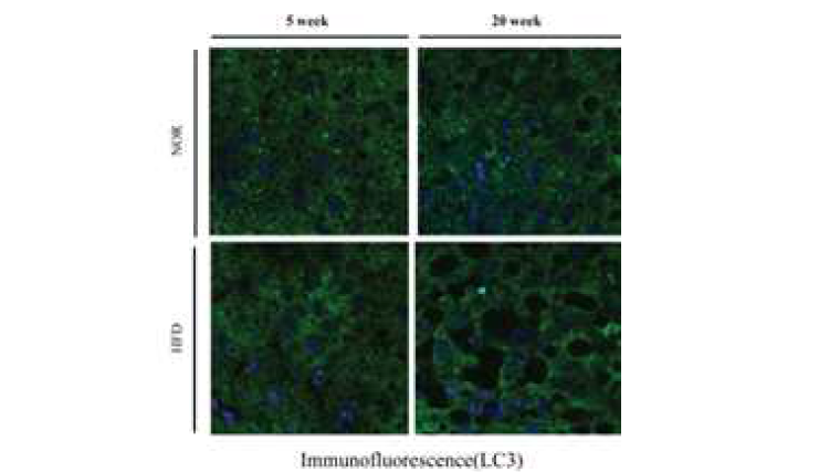 LC3 immunofluorescence 분석