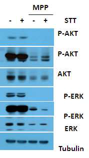 MPP+가 처리된 SH-SY5Y cell에 STT가 미치는 signal 변화