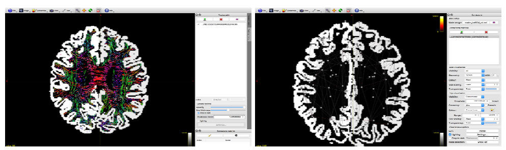 Extracted streamlines from brain image data (left), and resultant connectome data (structural brain network, right)