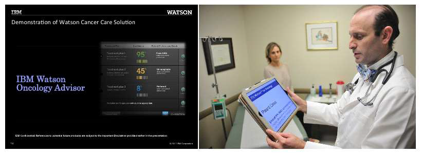 IBM Watson Oncology Advisor