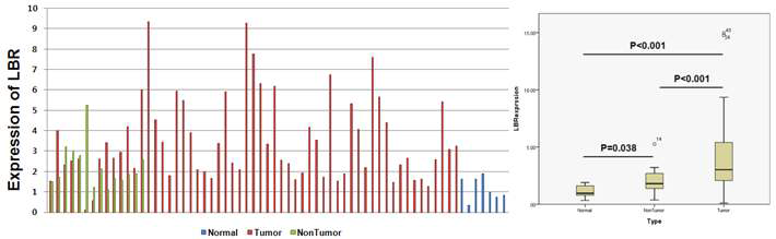 정상조직과 간암의 암 주변 조직, 간암조직에서 후보유전자인 LBR의 발현 양상