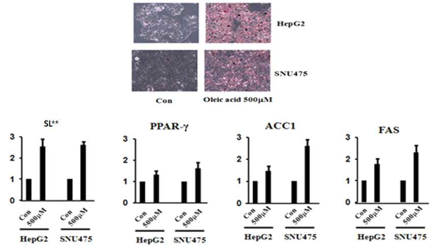 HepG2와 SNU475세포에서의 지방증 형성 과정