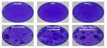 P31에 따른 Myc/Ras 유도에 의한 foci 변화