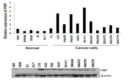정상, 암세포에서의 PRP 발현 양상