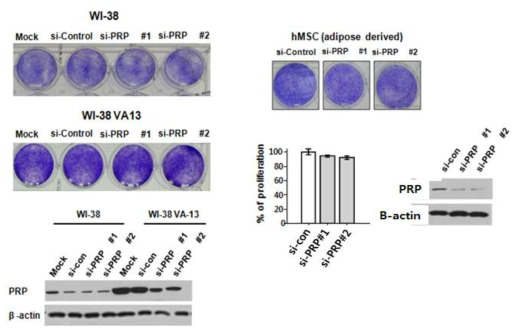 PRP 억제에 따른 정상세포 성장에의 영향