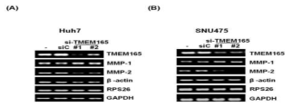 TMEM165는 MMP2를 통하여 암 침윤 조절