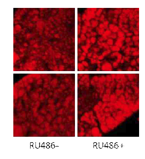 RU486을 먹인 Actin-GS-Gal4/UAS-FBP-RNAi 초파리의 지방체 조직의 지방을 나일레드(Nile red) 염색한 후 찍은 공초점 현미경 사진