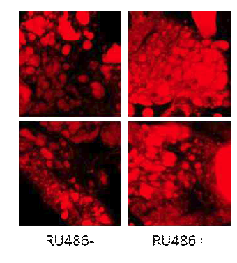 RU486을 먹인 Actin-GS-Gal4/UAS-T3dh-RNAi 초파리의 지방체 조직의 지방을 나일레드(Nile red) 염색한 후 찍은 공초점 현미경 사진