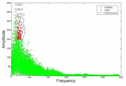 25% 폐색관의 SVM structure