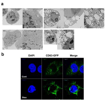 Mutivesicular endosomes are formed in the apoptotic process