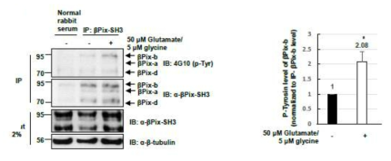 Glutamate stimulation 이 βPix-b의 인산화를 특이적으로 증가시킴.