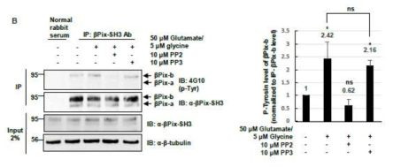 βPix-b의 Y598 인산화는 Src inhibitor인 PP2에 의해 저해됨.