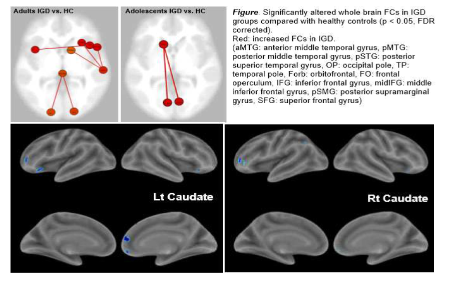 Functional connectivity in adolescents with Internet gaming disorder