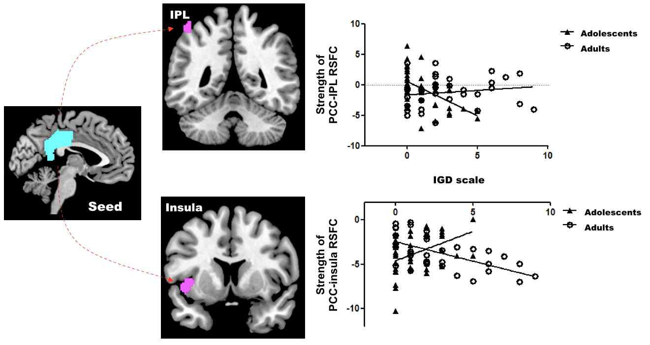 연령 집단과 IGD 척도 점수와의 상호작용 효과를 보이는 뇌 영역