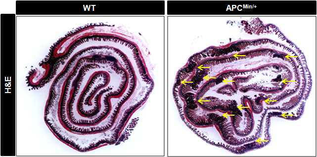 WT, APCmin/+mice의 회장 부분을 Swiss roll 형태로 section하여 H&E staining한 결과, APCmin/+mice에서 현저하게 증가한 polyp 형성능을 관찰. (노란 색 화살표 : 형성된 polyp)