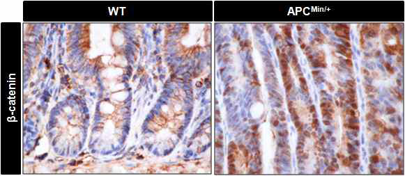 15주령 WT, APCmin/+mice의 samll intestine 조직에 서 β-catenin의 활성을 DAB staining을 통해 확인함.