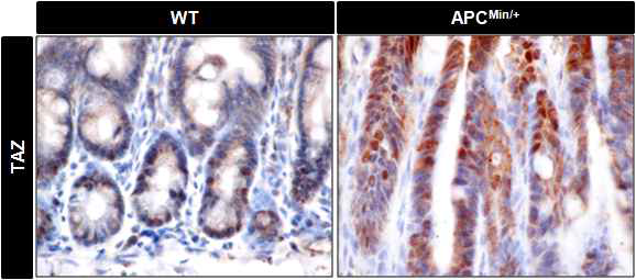 WT mice의 crypt에서 발현되는 TAZ 단백질이 APC가 mutation된 mice에서는 발현이 현저하게 증가되고, 핵으로 localization 되어있음을 확인함.