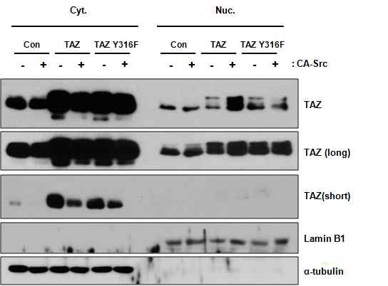 TAZ Y316F mutant에 의한 TAZ localization의 변화