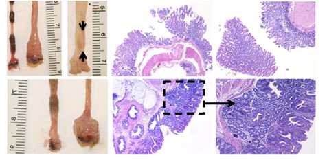 Hippo 신호의 억제 (Mst1null/Mst2ff/villin-Cre mice) 는 epithelial hyperplasia, dysplasia, 그리고 adenoma (윗그림 화살표)를 유도한다.