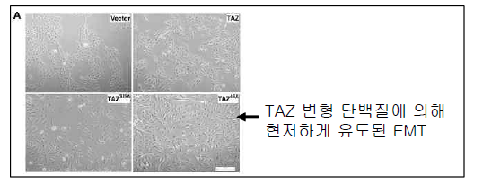 EMT를 촉진하는 TAZ. (A) 과발현된 TAZ 변형 단백질은 세포의 EMT를 촉진시킴