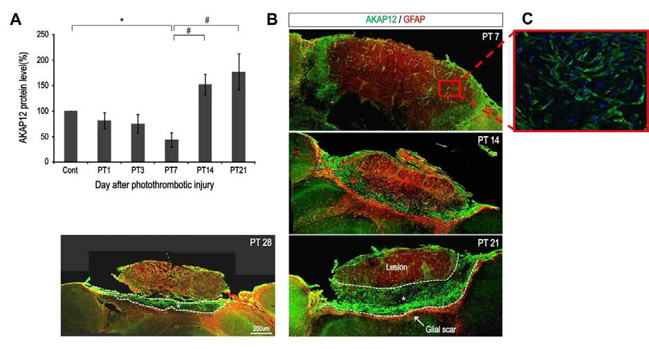 PT 모델 유발 후 시기별 AKAP12의 발현 양상