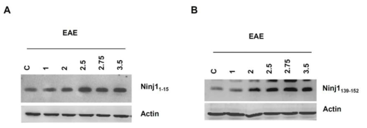 생쥐 척수의 EAE 시기별 Ninjurin1의 발현 패턴