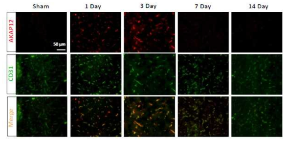 MCAO mice 모델 유발 후 각 0, 1, 3, 7, 14일째 되는 날 AKAP12의 발현패턴 조사