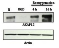 혈관내피세포에 OGD를 8시간 처리한 후 각 4시간, 16시간동안 reoxygenation 후 western blot analysis를 통한 AKAP12의 발현 패턴 조사