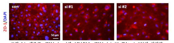 대조군 siRNA (con)과 AKAP12 siRNA (si #1 또는 si #2)가 처리된 내피세포에서 tight junction 단백질인 ZO-1의 발현 패턴