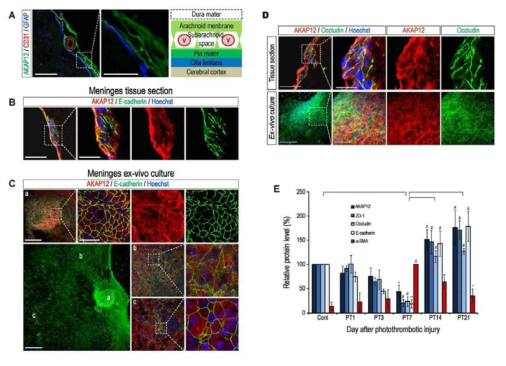 뇌수막와 fibrotic-glial scar에서 AKAP12를 과발현하는 세포타입의 규명