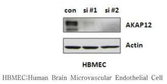 siRNA를 이용한 혈관 내피 세포에서의 AKAP12 발현 억제