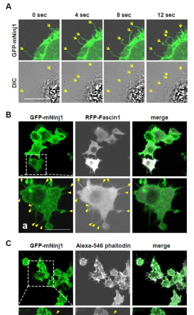 Filopodia에서의 Ninjurin1의 발현