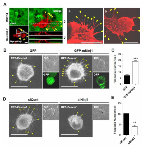 Ninjuirn1에 의한 Filopodia 형성이 Transendothelial migration (TEM)에 미치는 영향