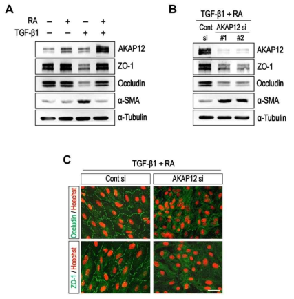 AKAP12가 중계하는 RA에 의한 TGF-β1의 억제효과