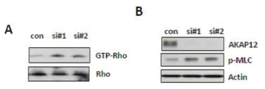 HBMEC에서 AKAP12 siRNA 처리 후, Rho pathway 활성 측정