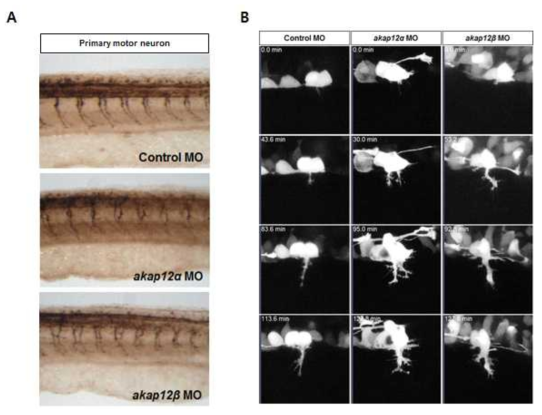 AKAP12가 제브라피쉬 배아의 신경세포 발생과정에 미치는 영향 관찰