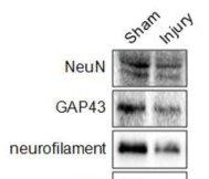 TBI 유발에 따른 신경 세포관련 단백질들의 발현 변화.