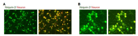 신경세포와 Neural stem cell에서 Ninjurin2의 발현 패턴.