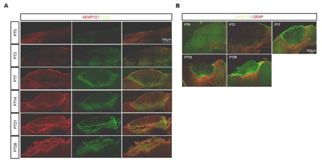 PT 유발 뇌 조직의 시기별 AKAP12, 대식세포의 발현 분석