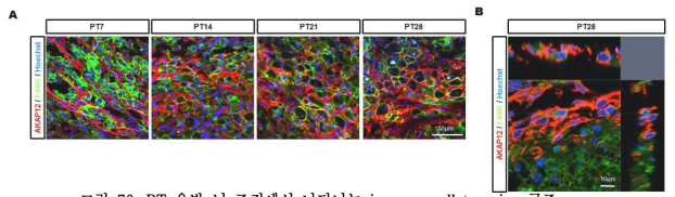 PT 유발 뇌 조직에서 나타나는 immune cell trapping 구조