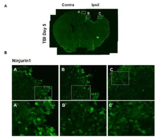 CCI 생쥐 뇌에서 Ninjurin1의 발현조사 A) Ninjurin1의 면역염색 (CCI day5). B) Ninjurin1 면역 염색의 고배율 이미지