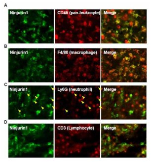 Myeloid 계열의 세포에서의 Ninjurin1 발현