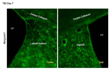 7일째 CCI septum에서의 Ninjurin1의 발현