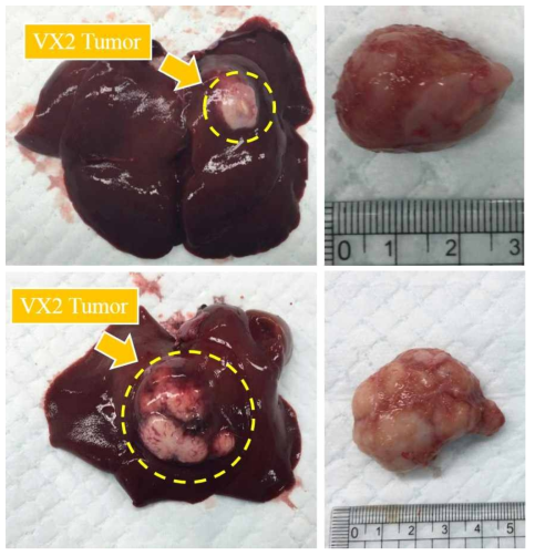이식한 VX에 따른 종양크기 확인